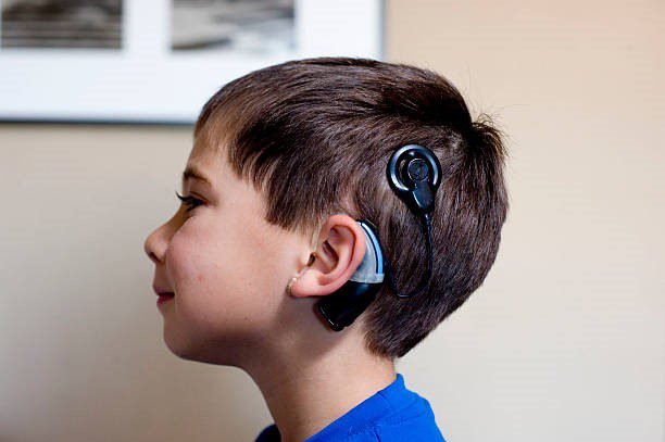 Cochlear Implants | Hajela Hospital